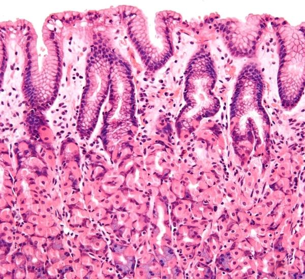 Prepared Microscope Histology Slides for Medical Education